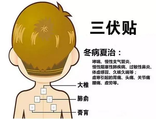 2、三伏貼的功能和功效是什么？