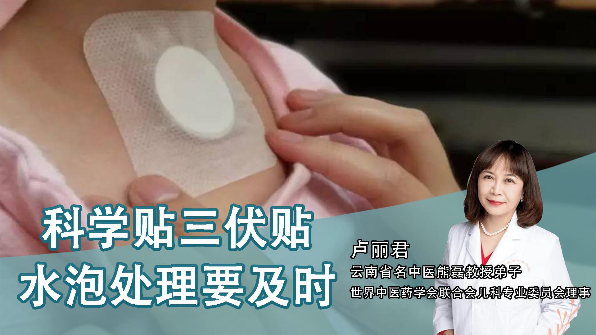 2、貼三伏貼后有什么禁忌？