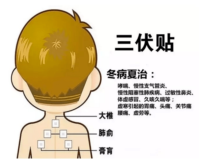 1、三伏貼多大？寶寶能貼多少？</p><p>三伏貼孩子貼多久？